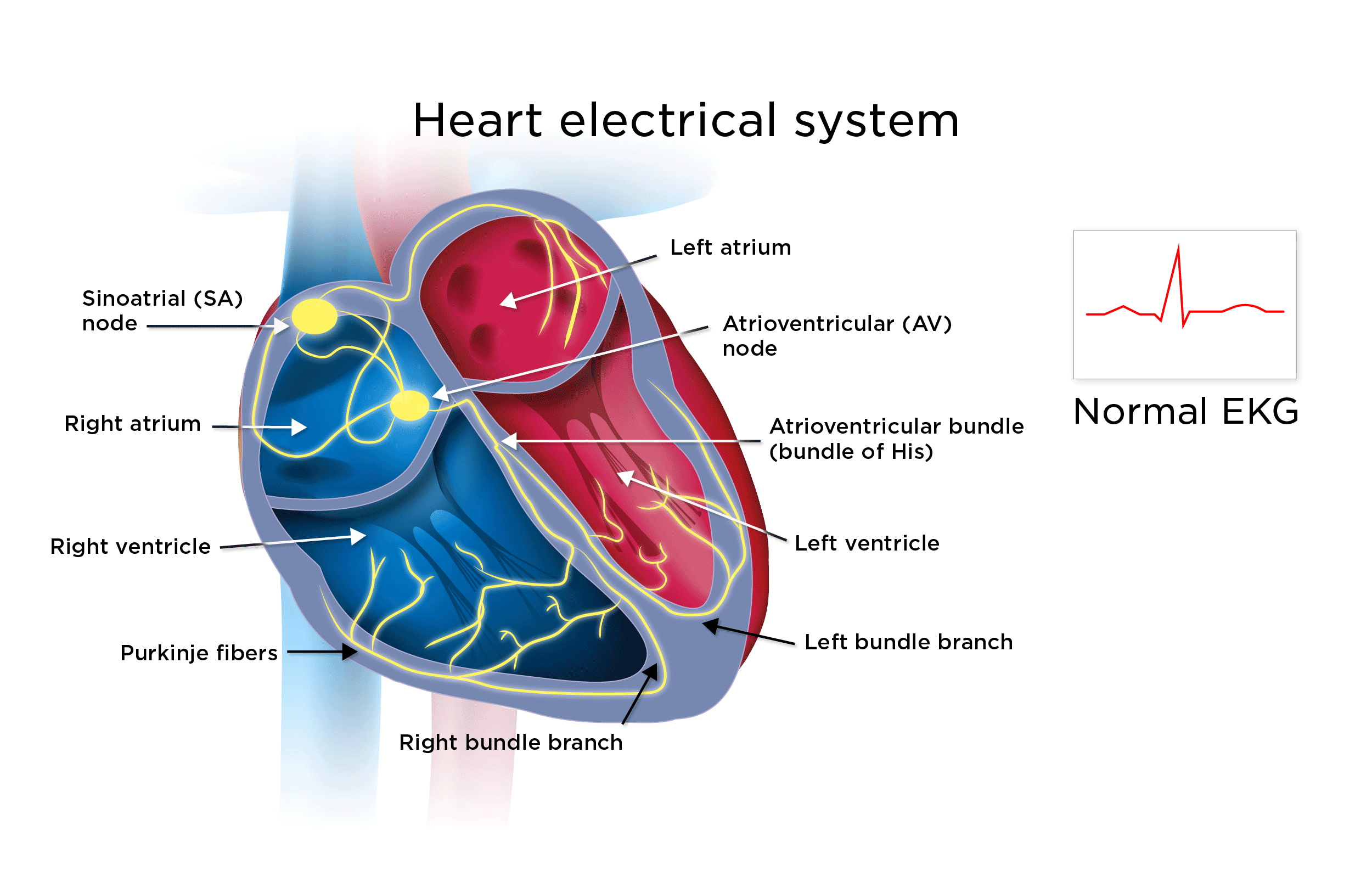 compete-heart-block-symptoms-causes-treatment-outlook